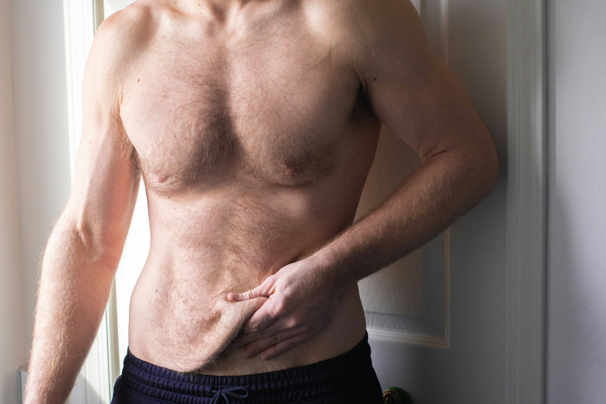 man grabbing skin flap