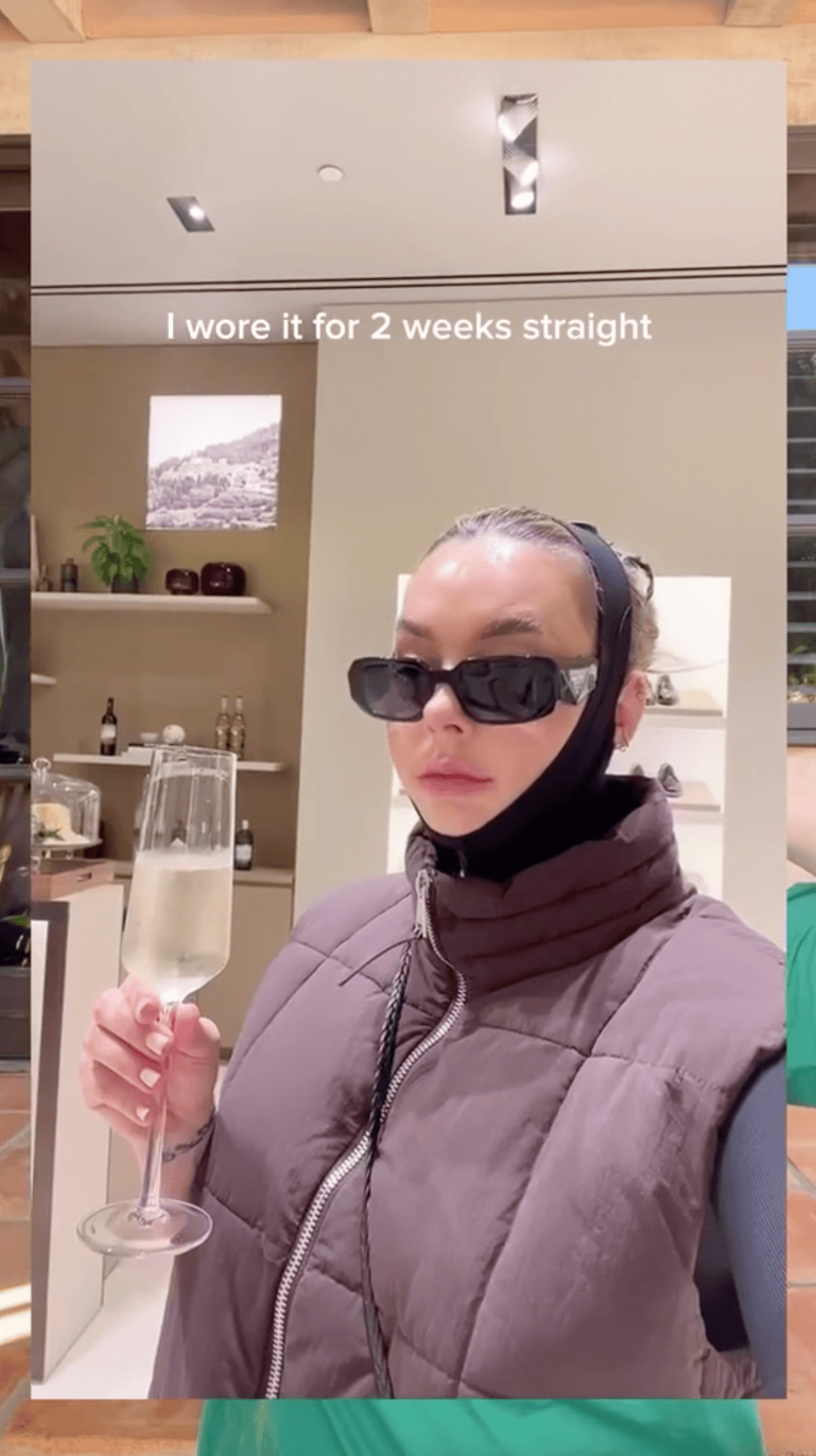Lauryn Evarts Bosstick holding a champagne glass with compression garment on chin