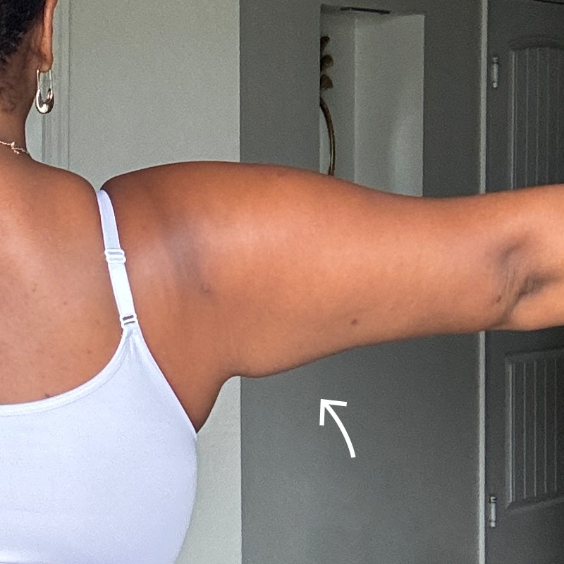 Zoe Arm After