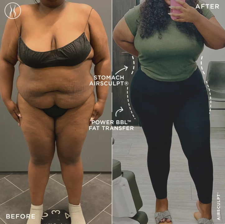 Plus sized BBL Before and after