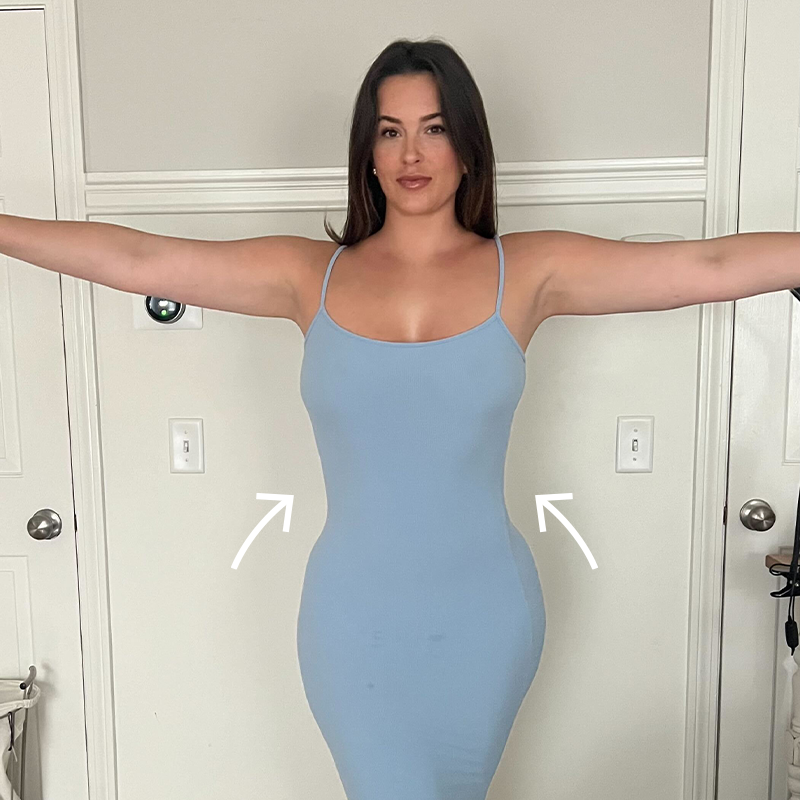 Caroline after airsculpt