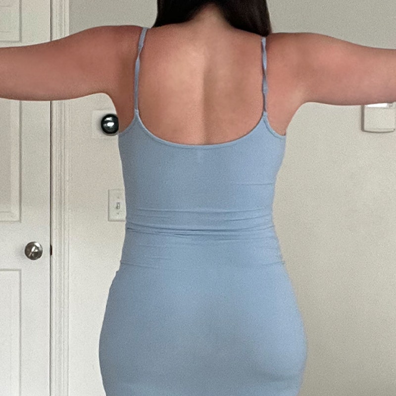 Caroline before airsculpt