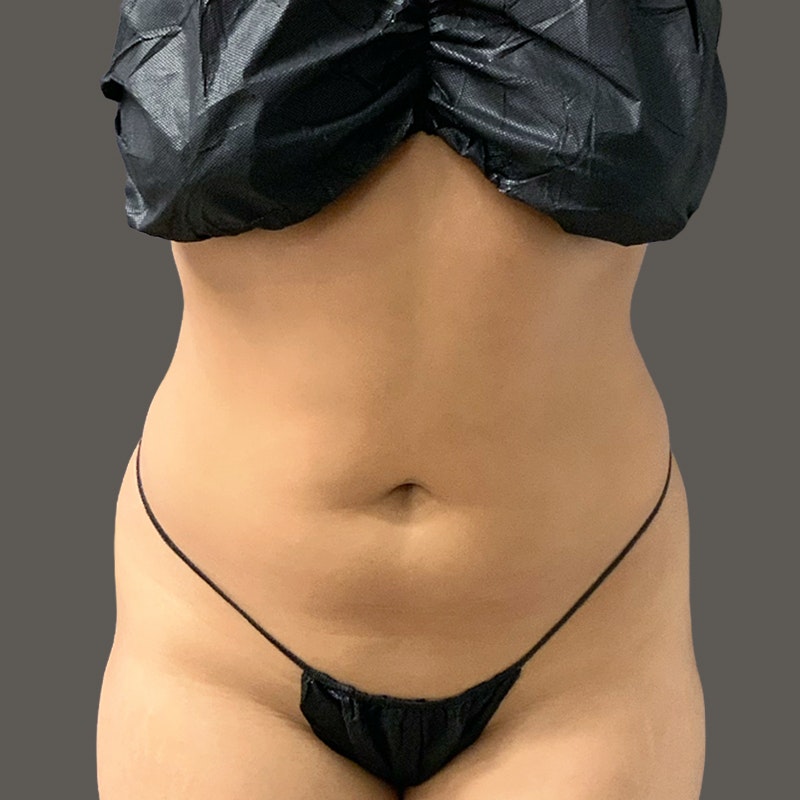 Aiyana Lewis Before