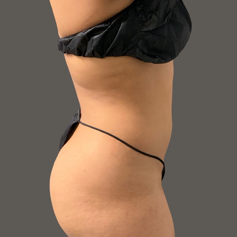 Aiyana Lewis Before