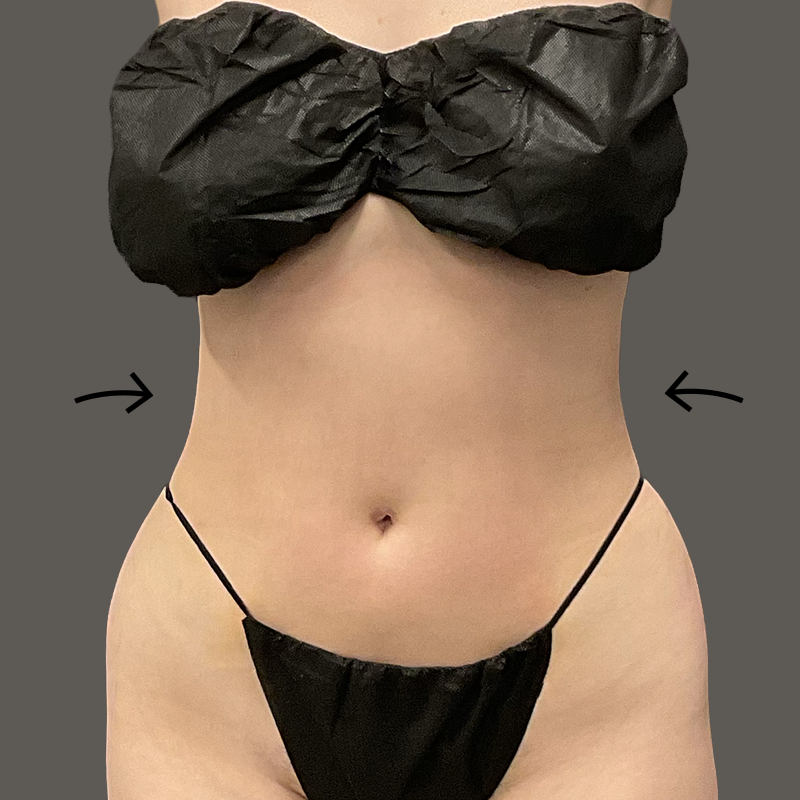 Stomach