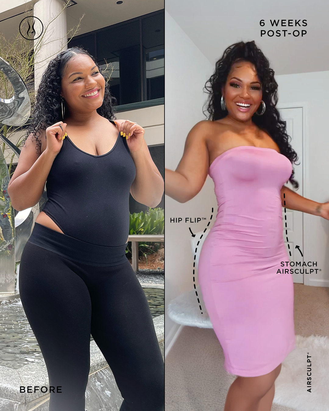 before and after