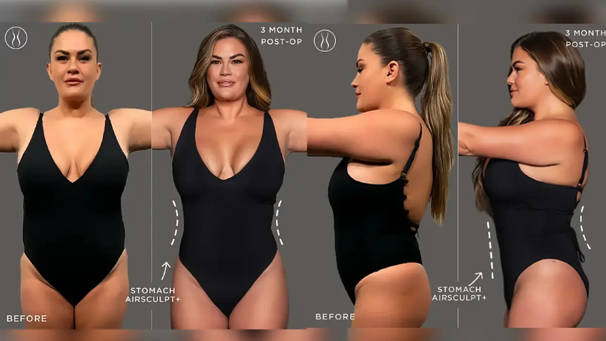 Before and after images of woman in black bodysuit showing stomach contour improvement three months after AirSculpt procedure