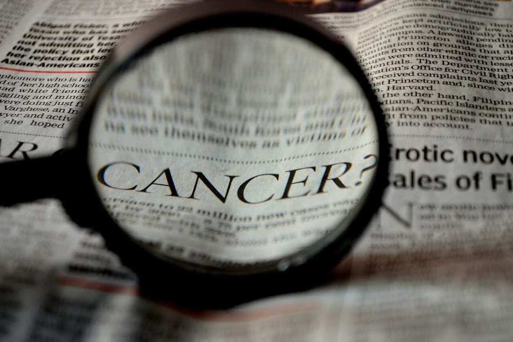Delayed cancer scans raise fears over late detection