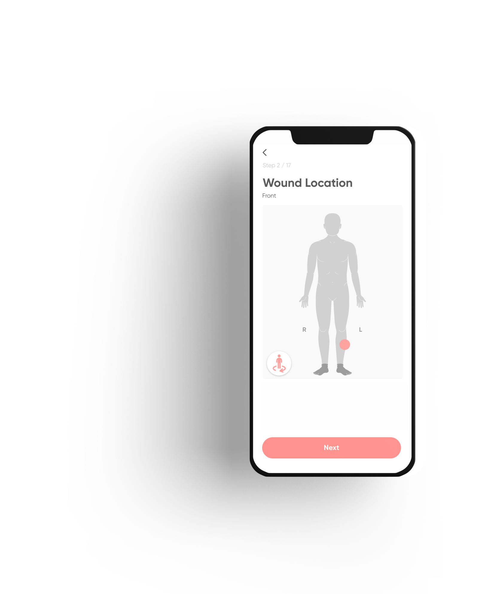 Wound mobile view 