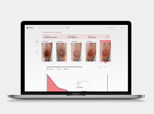 Tracking wound progression with Minuteful for Wound portal