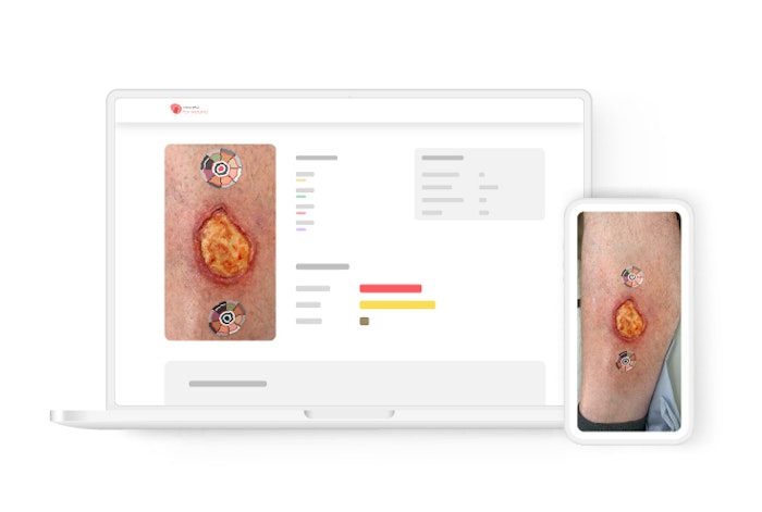 Color brings wound care management to life