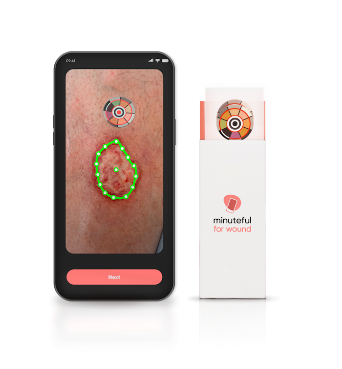 Using Minuteful for Wound
