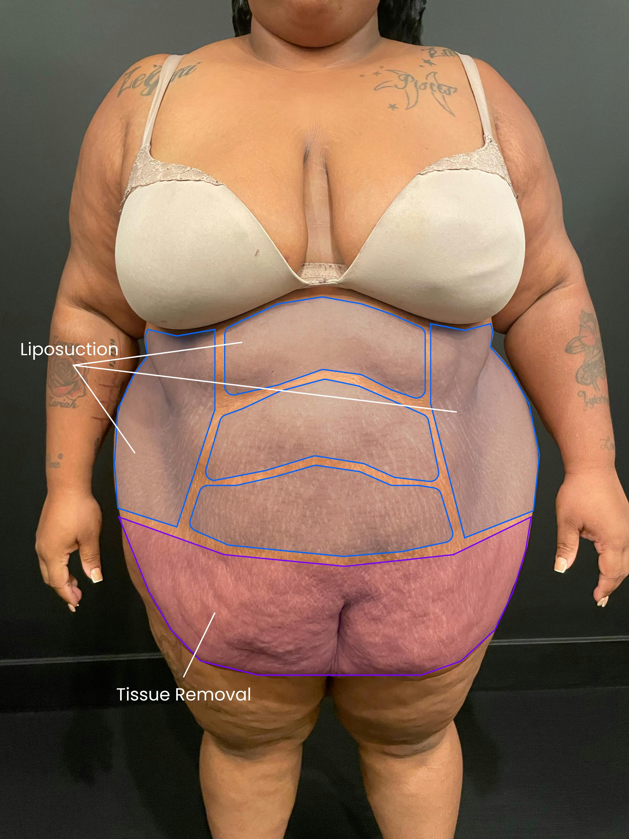 Patient A Before Photo