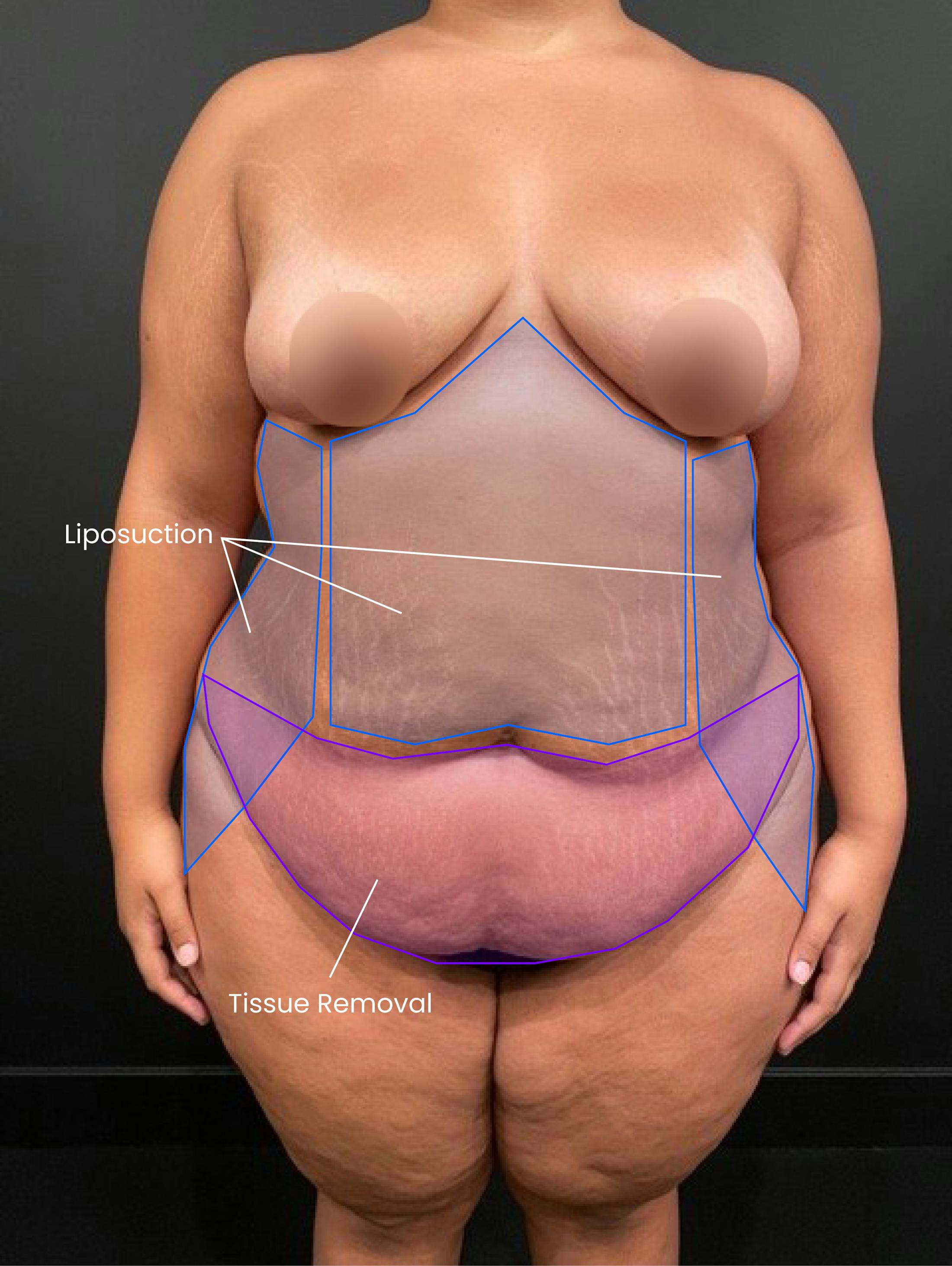 Patient B Before Photo