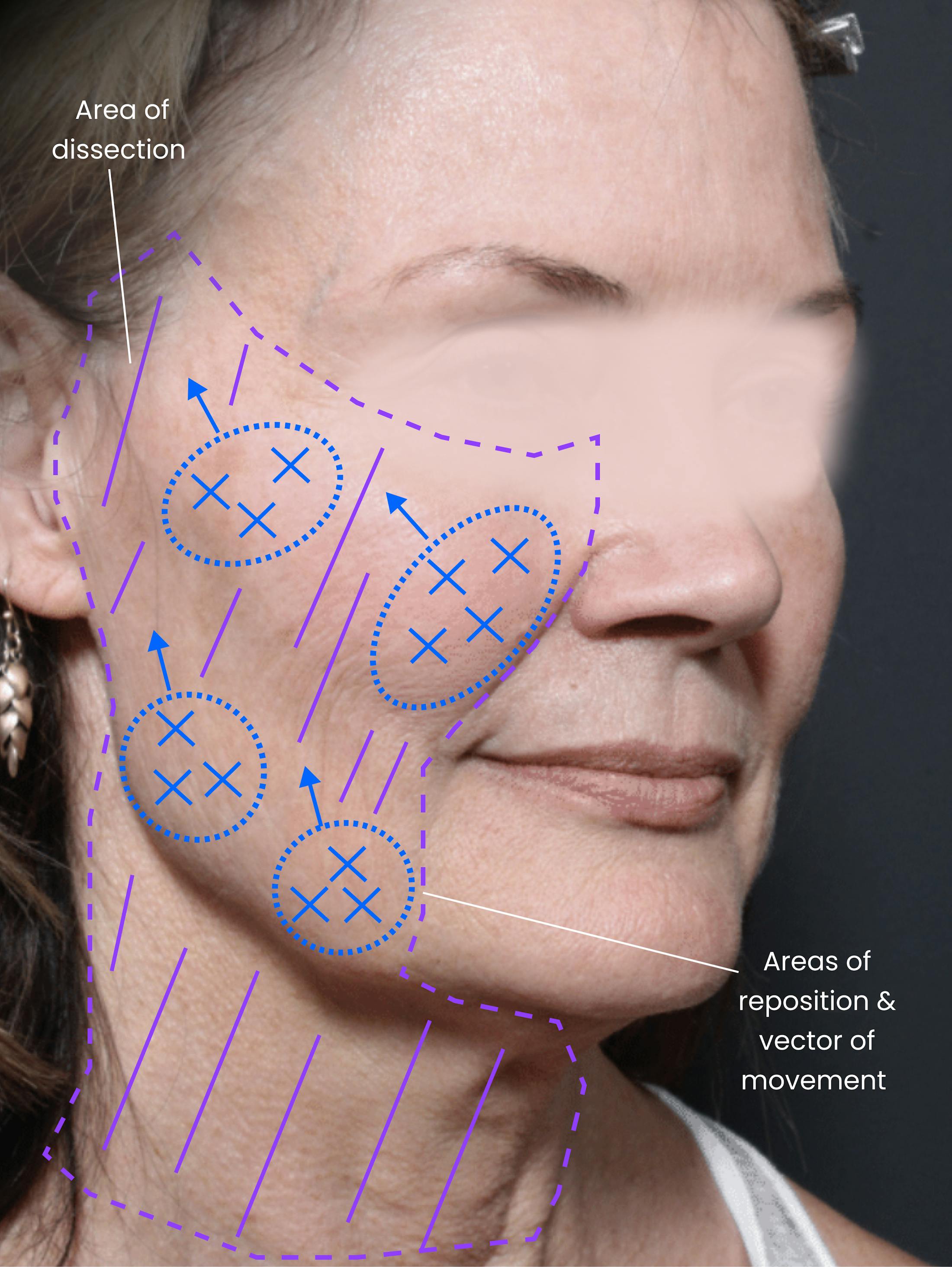 Patient B Before Photo