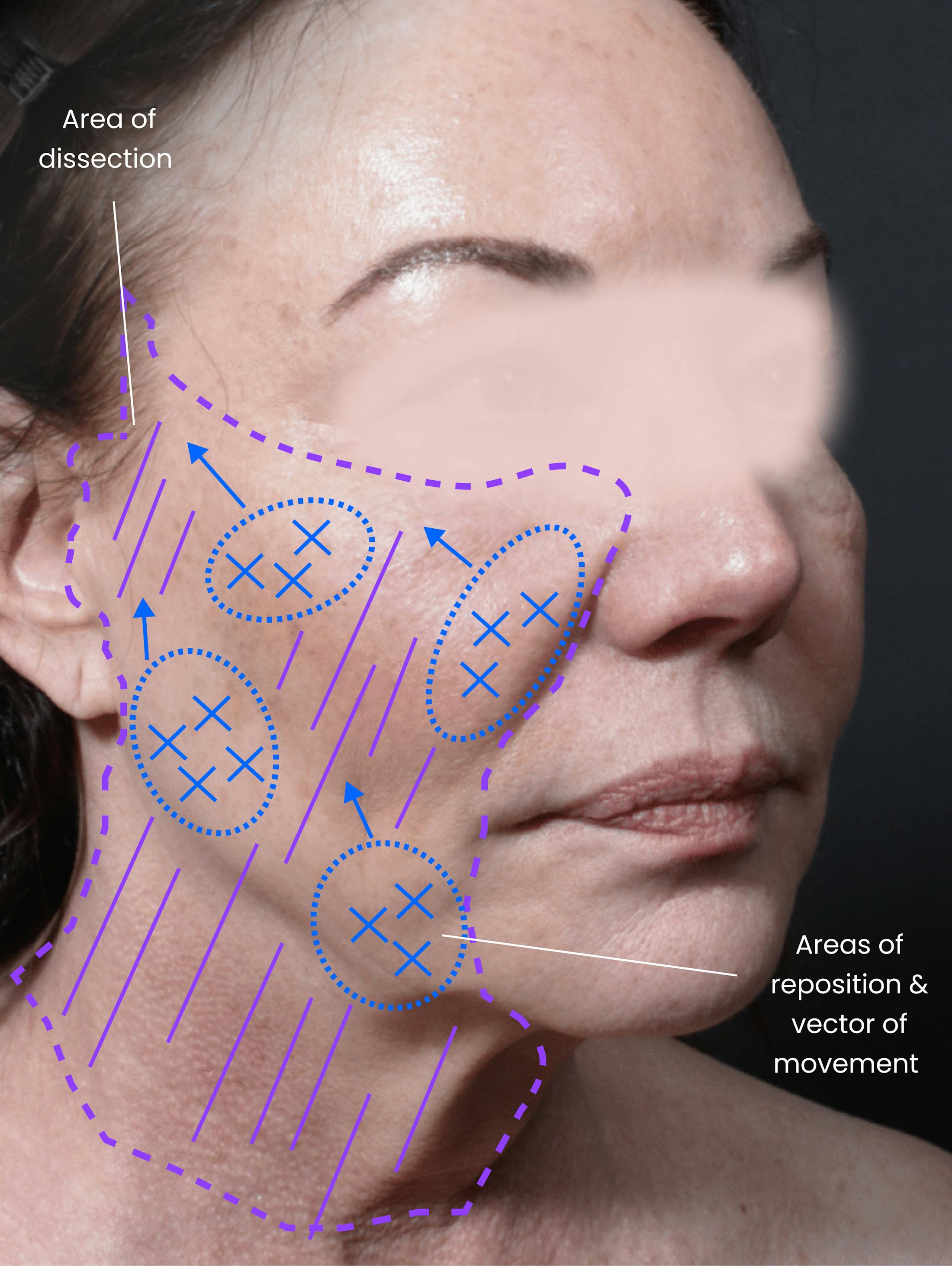 Patient A Before Photo