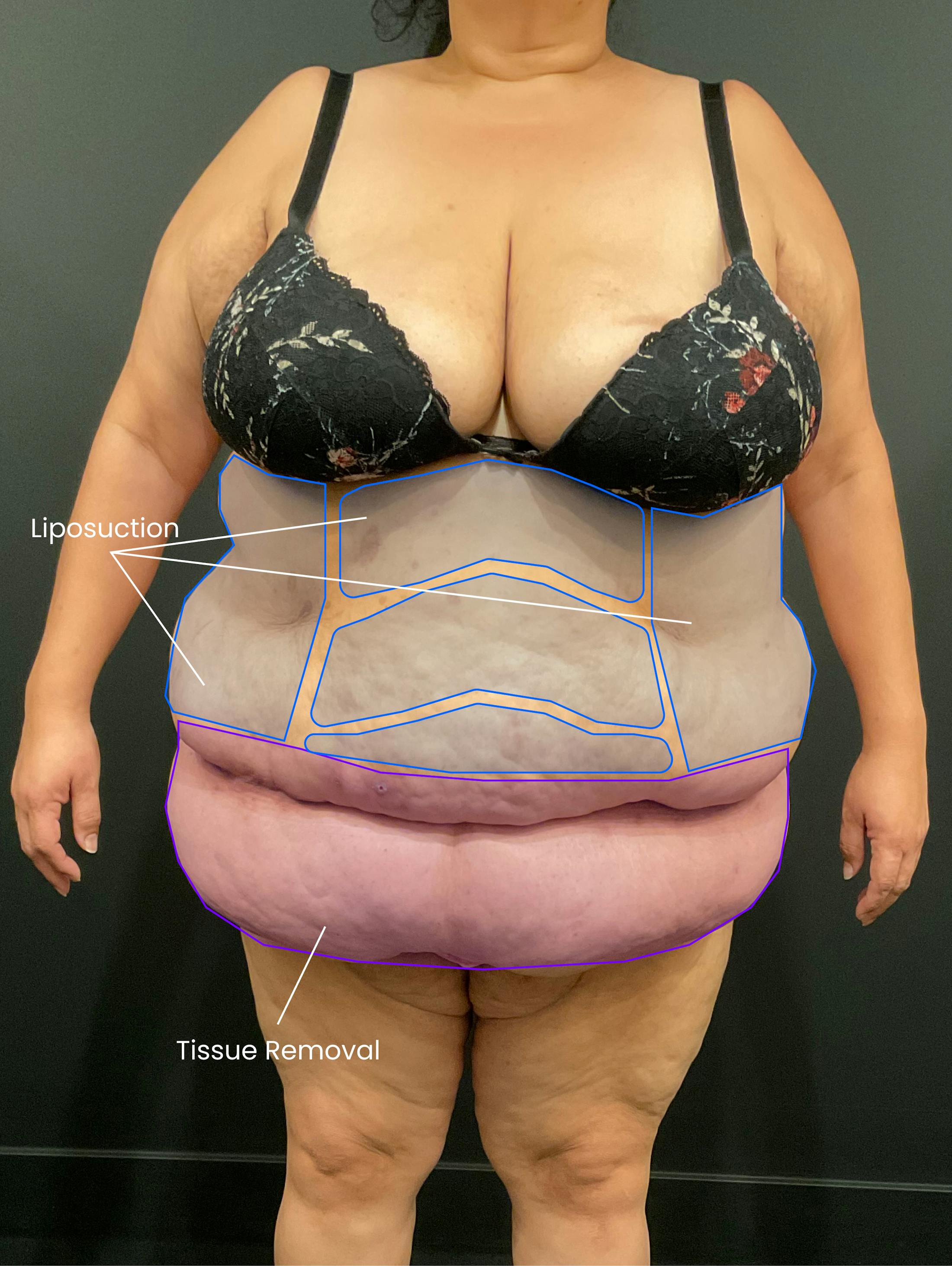 Patient D Before Photo