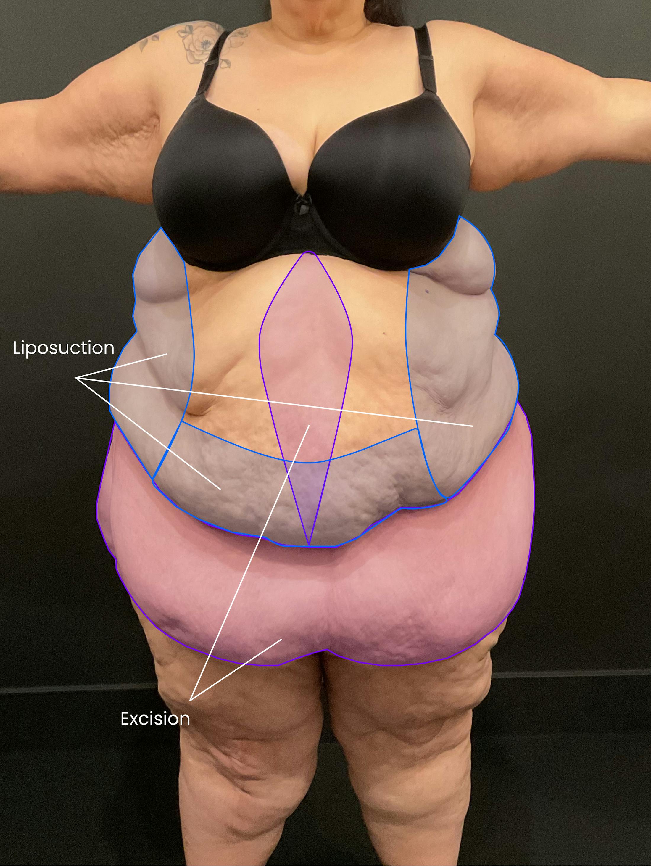 Patient E Before Photo