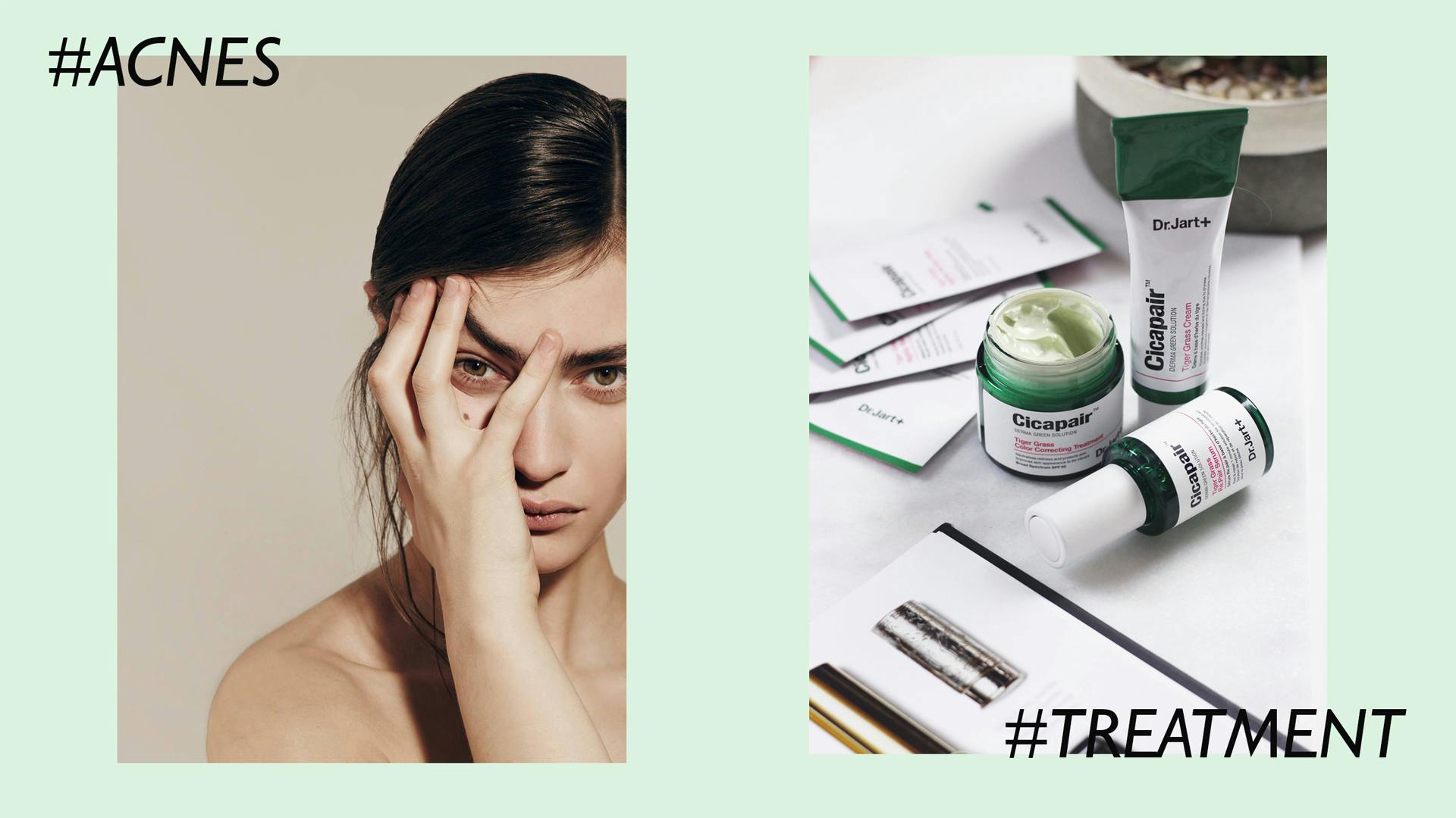 True or False: You Should Never Pop Pimples - How to Safely Pop Pimples Acne True or False: You Should Never Pop Pimples - How to Safely Pop Pimples Acne