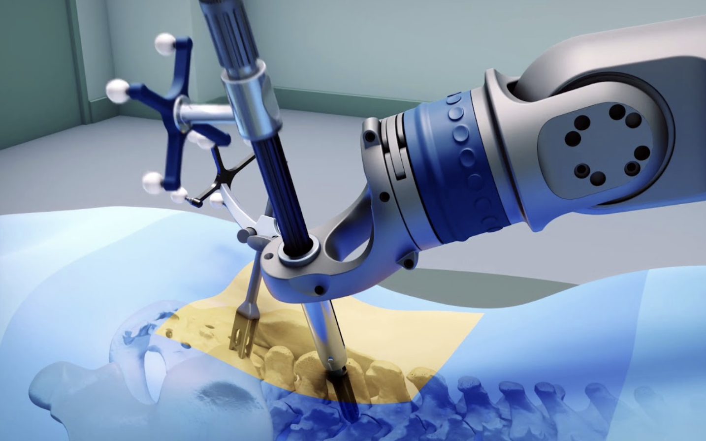 image of a robot working on a spine