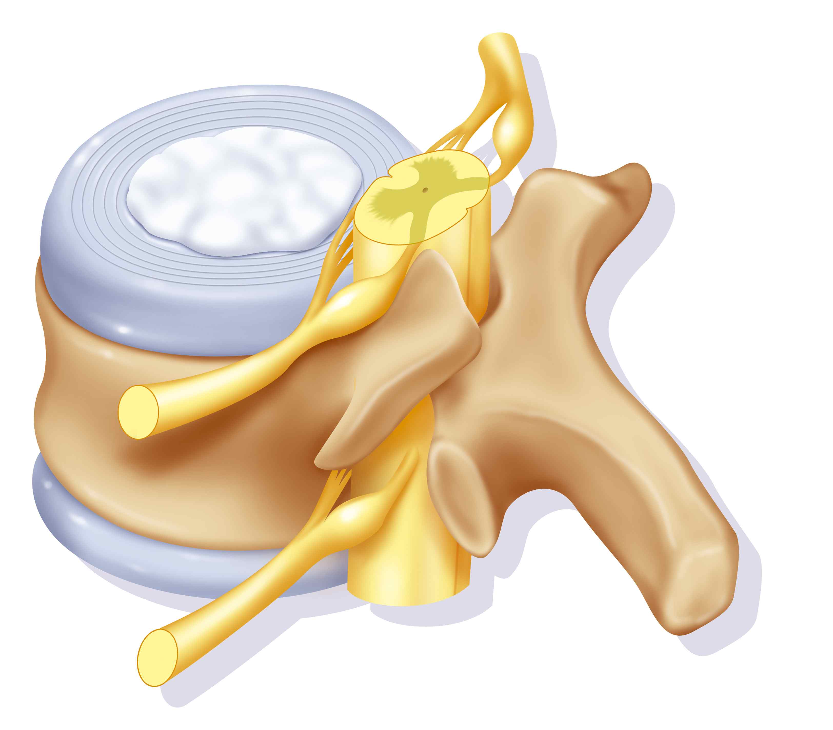 image of a spinal disc