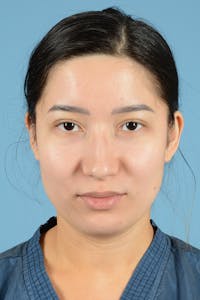 Facial Augmentation Before & After Gallery - Patient 187823949 - Image 1