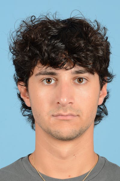 Rhinoplasty Before & After Gallery - Patient 714712 - Image 2