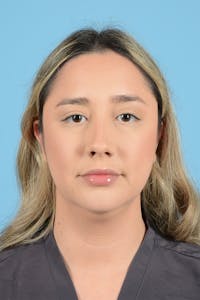 Rhinoplasty Before & After Gallery - Patient 189231 - Image 1