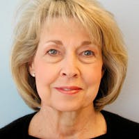 Facelift Before & After Gallery - Patient 359740 - Image 1