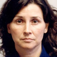 Facelift Before & After Gallery - Patient 784009 - Image 1