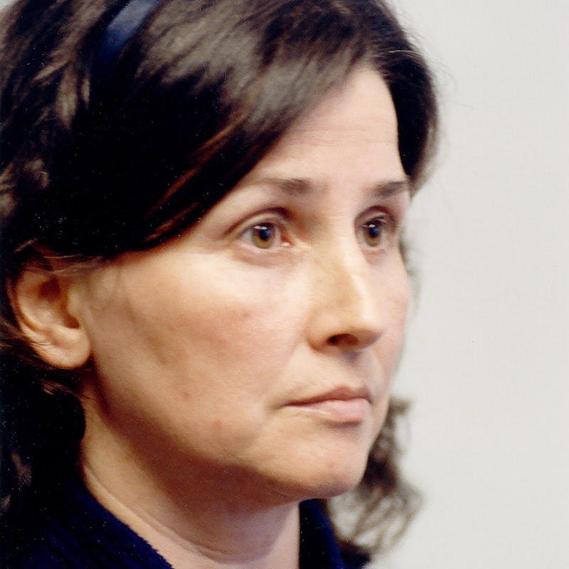 Facelift Before & After Gallery - Patient 784009 - Image 3