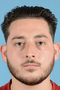 Rhinoplasty Before & After Gallery - Patient 318373 - Image 1