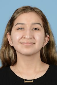 Rhinoplasty Before & After Gallery - Patient 336440 - Image 1