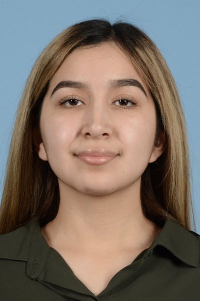 Rhinoplasty Before & After Gallery - Patient 336440 - Image 2