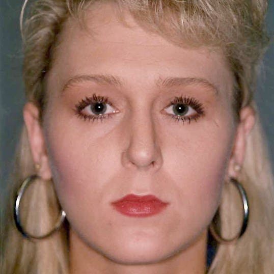 Rhinoplasty Before & After Gallery - Patient 330218 - Image 4
