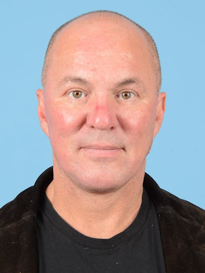 Facelift Before & After Gallery - Patient 140690 - Image 2