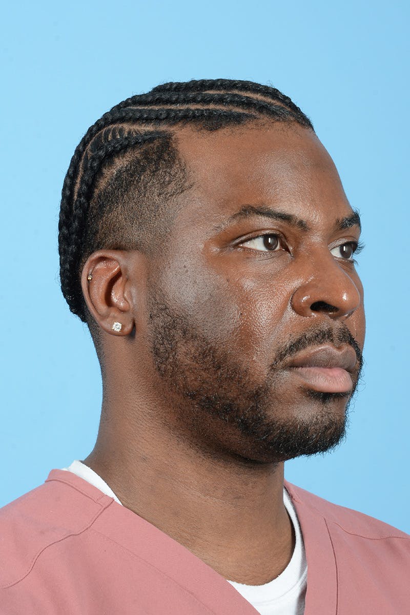 Facial Augmentation Before & After Gallery - Patient 264591 - Image 5