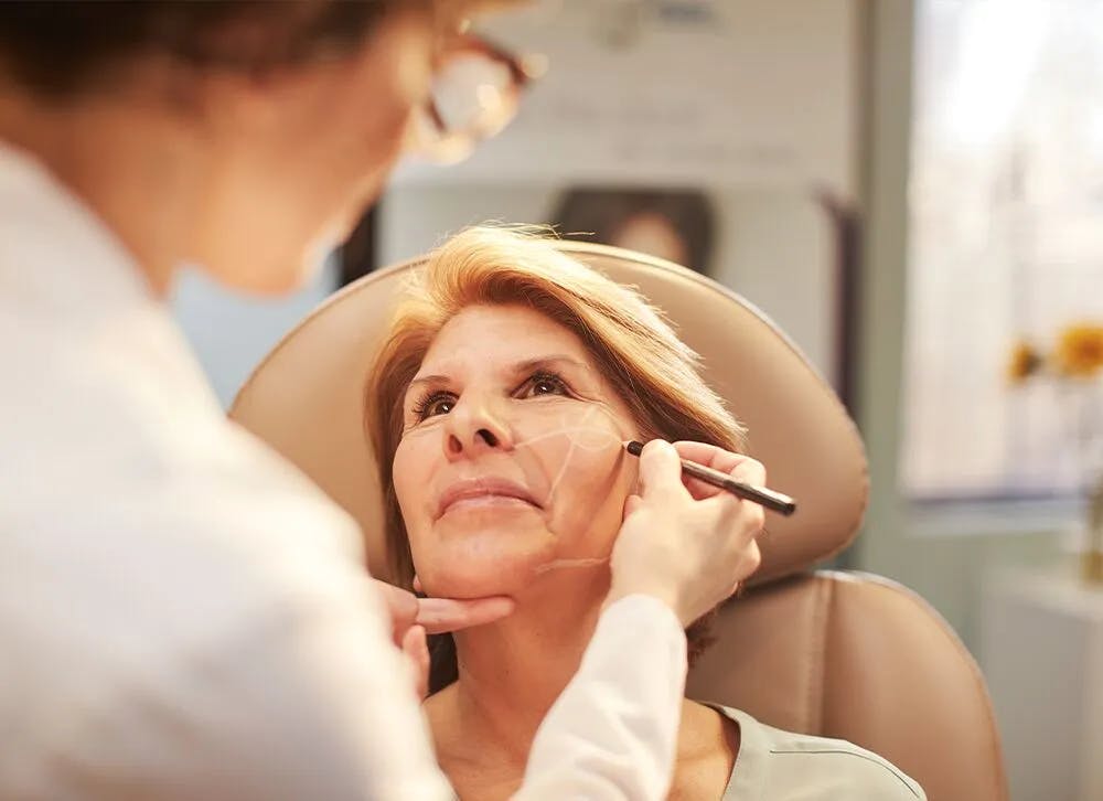 My Facelift at Age 70 Completed My Weight-Loss Transformation
