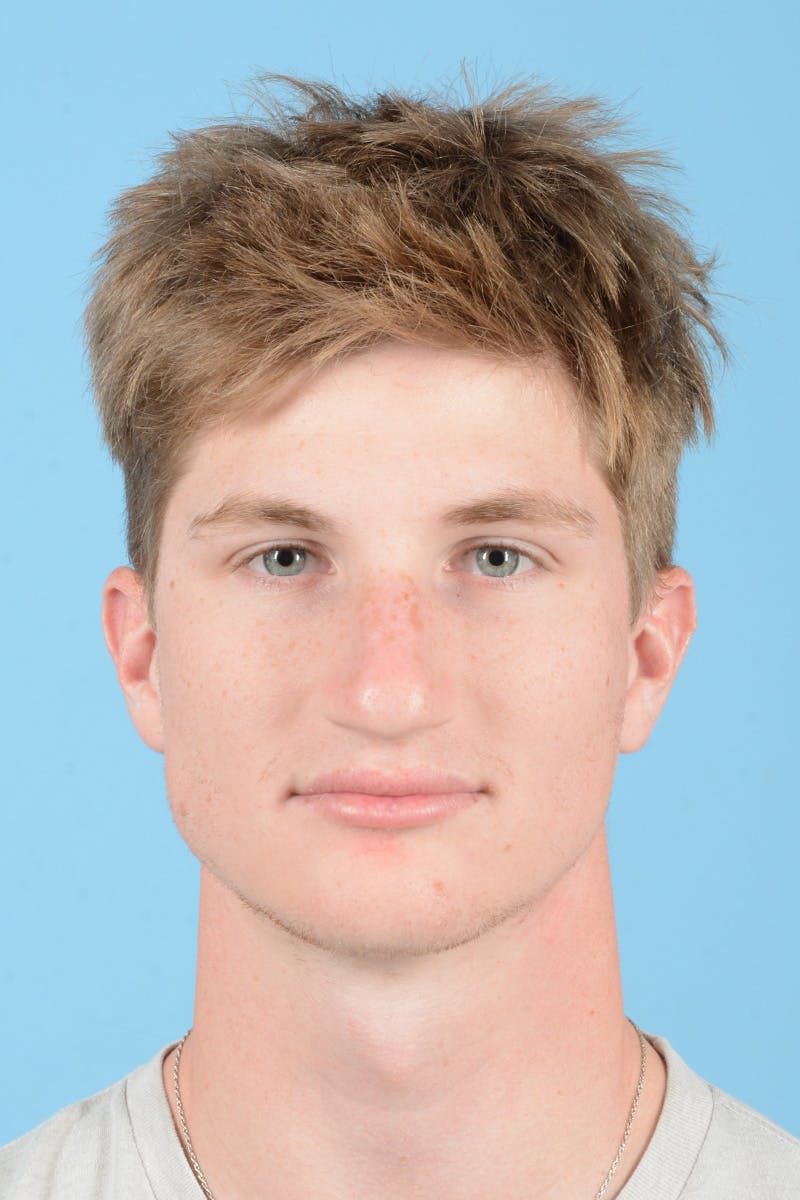 Rhinoplasty Before & After Gallery - Patient 156634 - Image 1