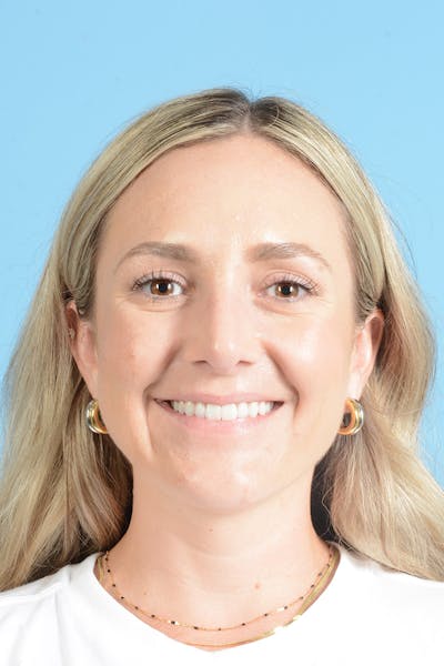 Rhinoplasty Before & After Gallery - Patient 172246 - Image 4