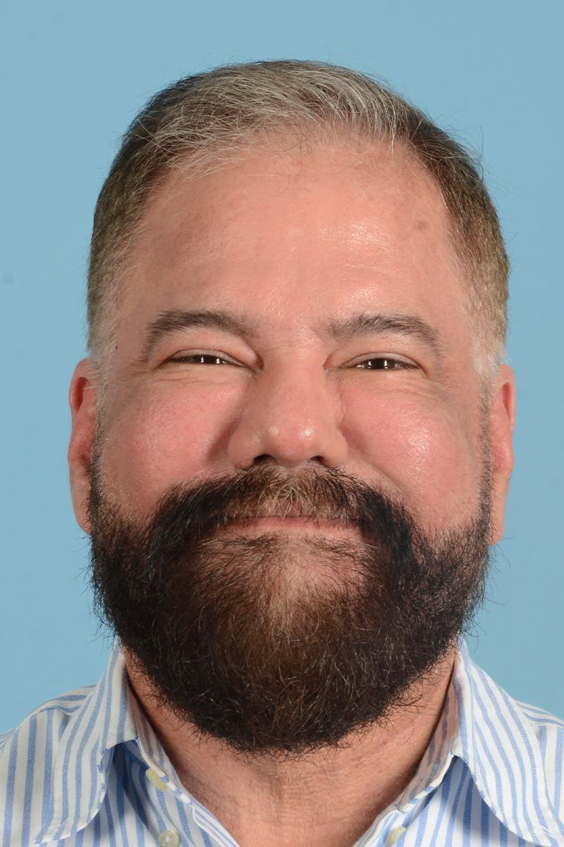 Facial Augmentation Before & After Gallery - Patient 172687 - Image 3