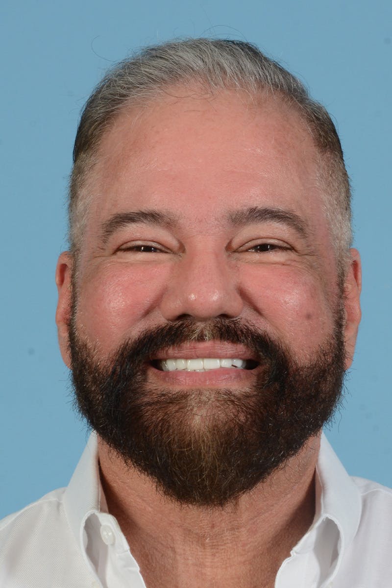 Facial Augmentation Before & After Gallery - Patient 172687 - Image 4