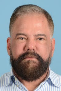 Facial Augmentation Before & After Gallery - Patient 172687 - Image 1