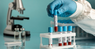 Accuprobe Diagnostics