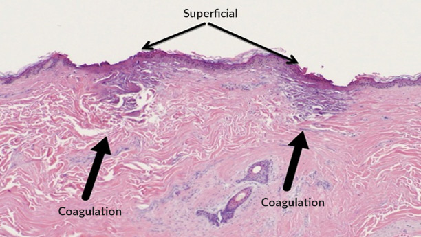 picture of skin