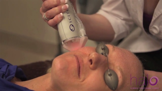 picture of a man getting lasered