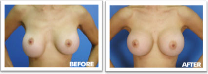 before and after picture