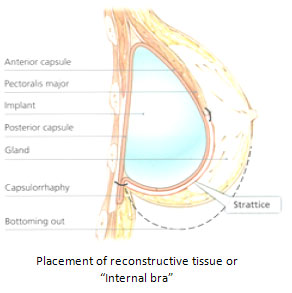 Bottoming Out  Sanctuary Plastic Surgery