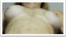 picture of boobs