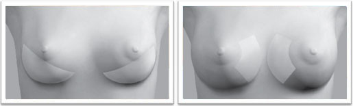 breast diagram